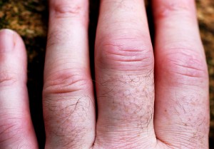 Diagnose